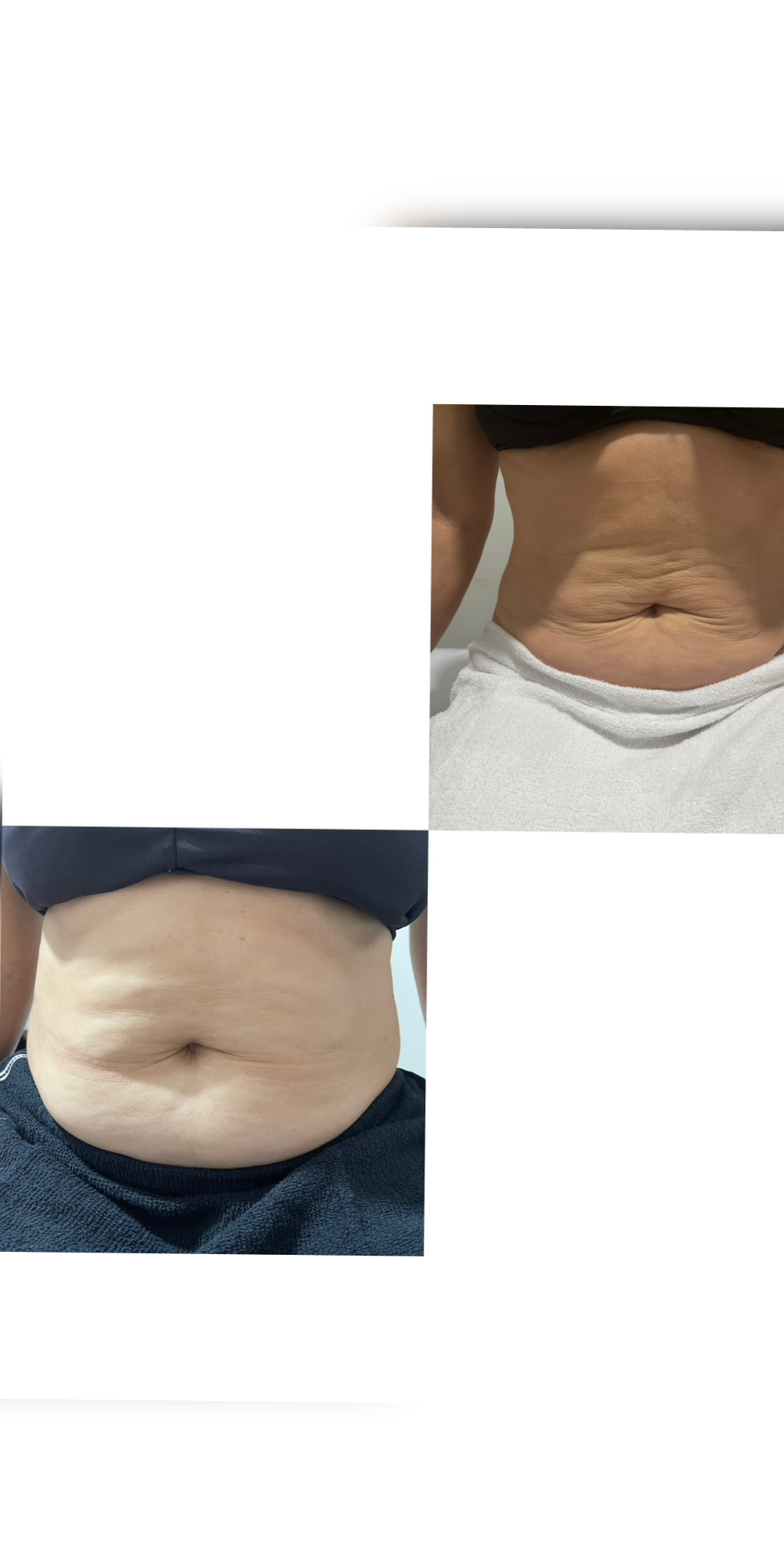 Resultado com 30 dias